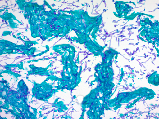 Periodic Acid Schiff (PAS) for Fungus Stain Kit