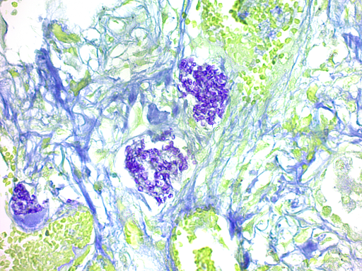 Pneumocystis Stain Kit