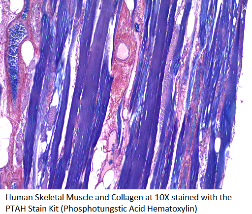 PTAH Stain Kit (Phosphotungstic Acid Hematoxylin)