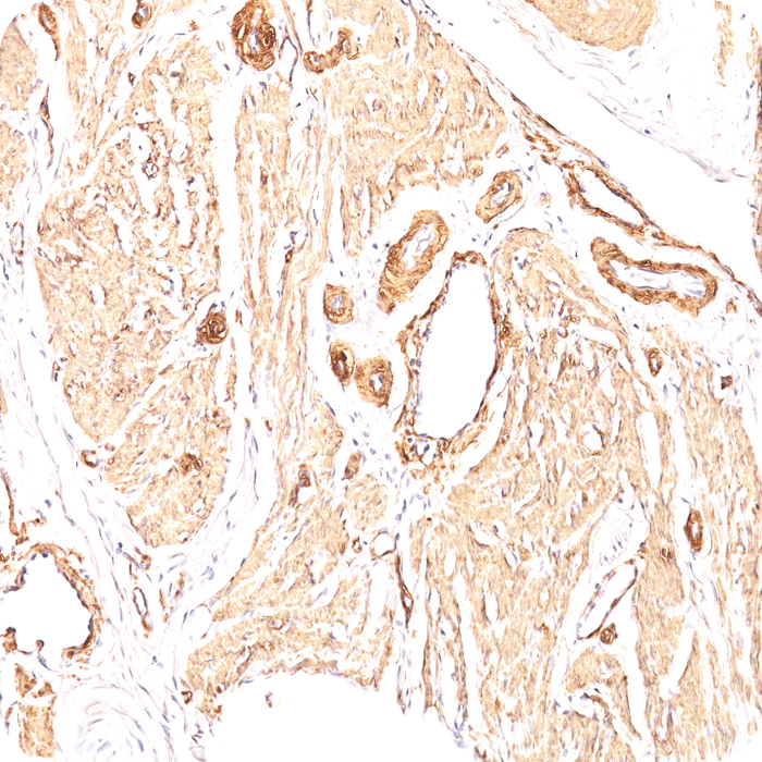 Actin, Smooth Muscle (Leiomyosarcoma Marker); Clone 1A4 (Concentrate)