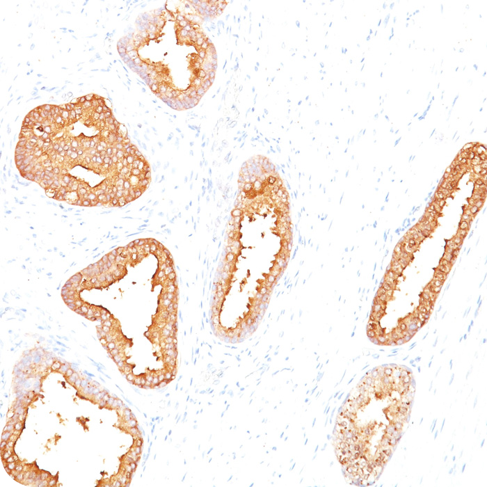 Prostate Specific Antigen (PSA); Clone A67-B/E3 (Concentrate)