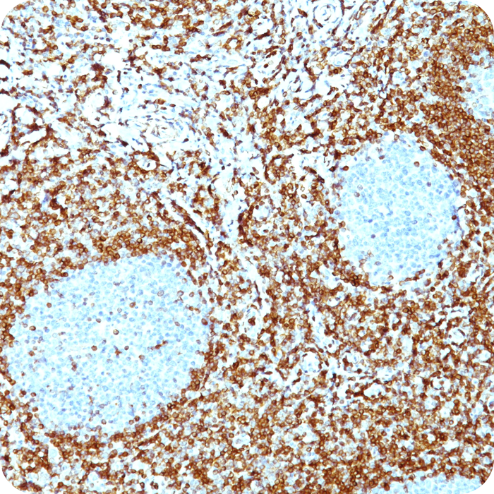 Bcl-2 (Apoptosis & Follicular Lymphoma Marker); Clone 100/D5 & 124 (Concentrate)