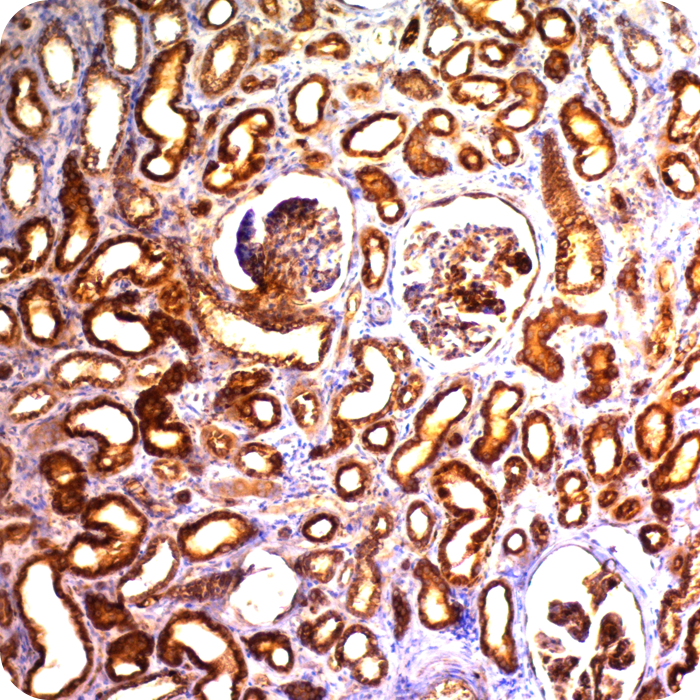 Complement 4d (C4d) (Acute Humoral Rejection Marker); Clone C4D204 (Concentrate)