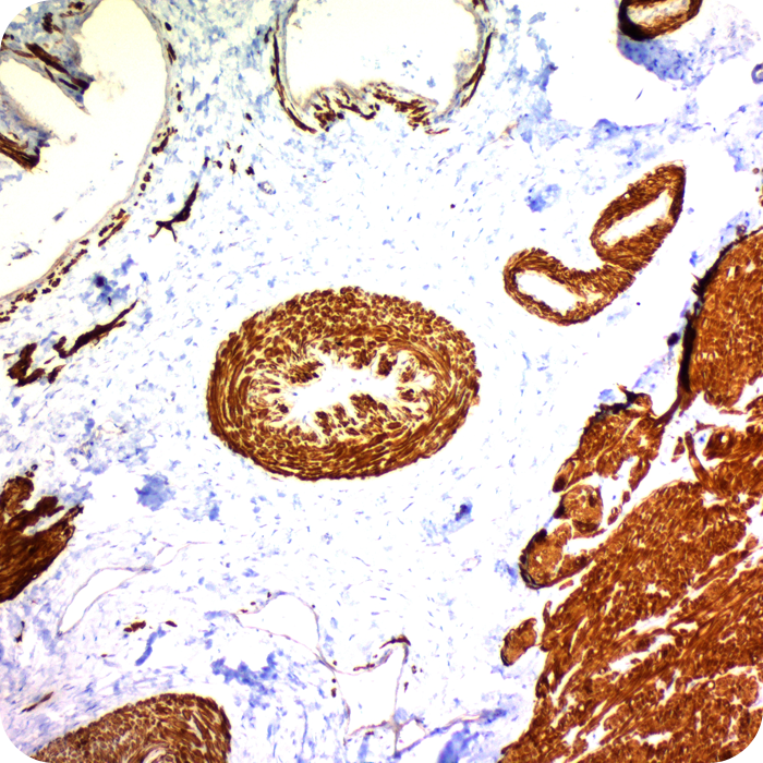 Caldesmon, HMW (h-Caldesmon) (Smooth Muscle Marker); Clone h-CALD (Concentrate)