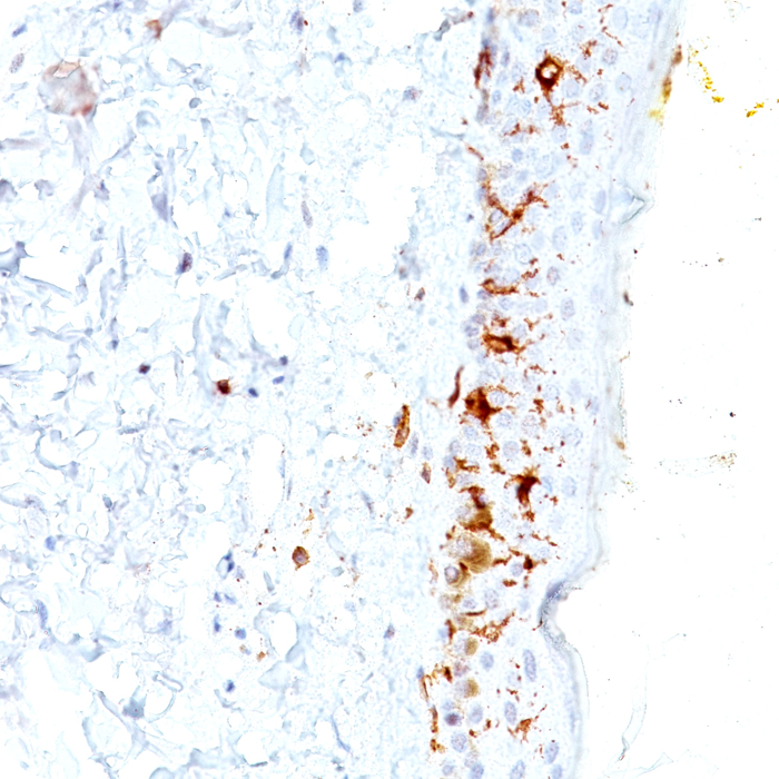 CD1a / HTA1 (Mature Langerhans Cells Marker); Clone C1A/711 (Concentrate)