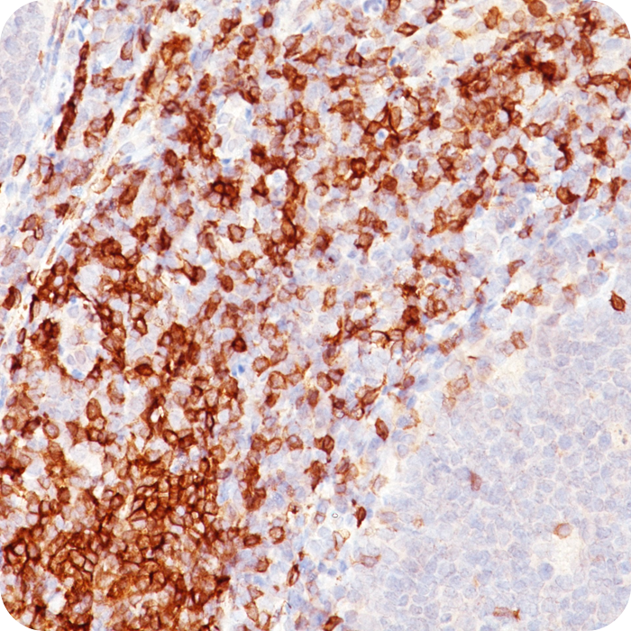 CD5 (Mantle Cell Lymphoma Marker); Clone C5/473 (Concentrate)
