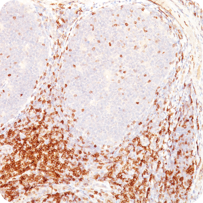 CD5 (Mantle Cell Lymphoma Marker); Clone CD5/54/F6 (Concentrate)