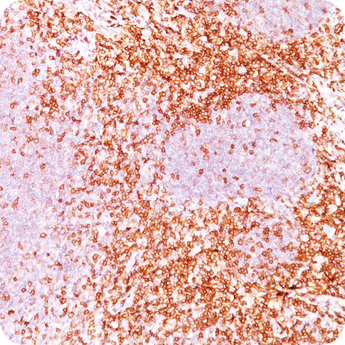 CD5 (Mantle Cell Lymphoma Marker); Clone C5/473 & CD5/54/F6 (Concentrate)