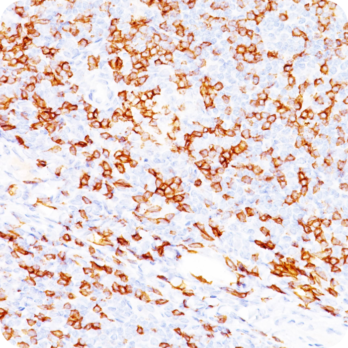 CD8A (Cytotoxic & Suppressor T-Cell Marker); Clone C8/468 (Concentrate)