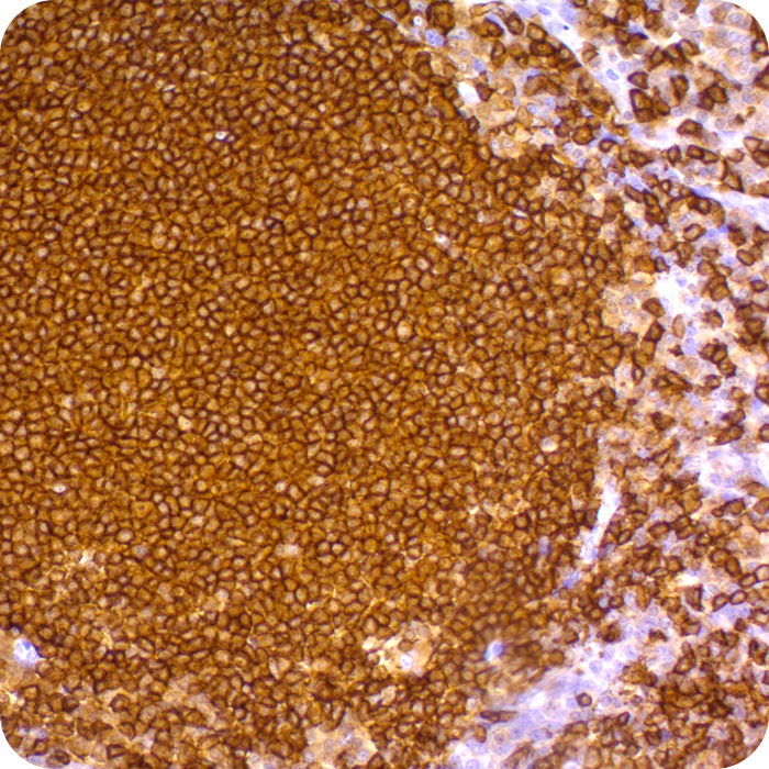 CD20 / MS4A1 (B-Cell Marker); Clone L26 (Concentrate)