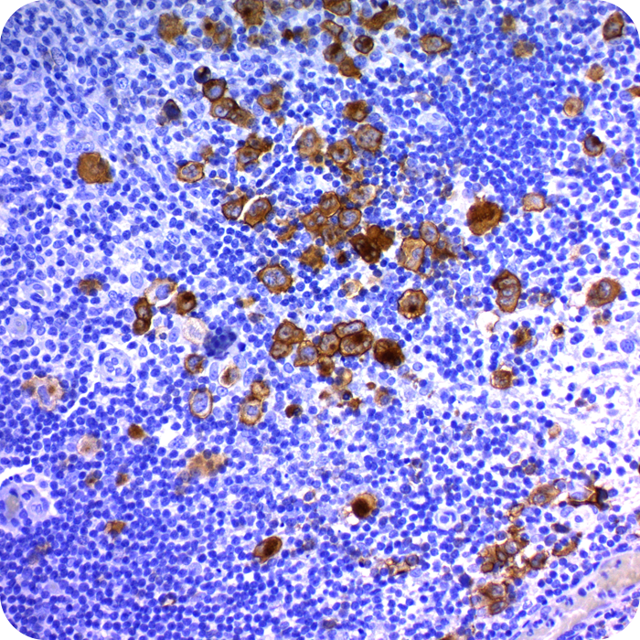 CD30 / TNFRSF8 (Hodgkin & Reed-Sternberg Cell Marker); Clone Ki-1/779 (Concentrate)