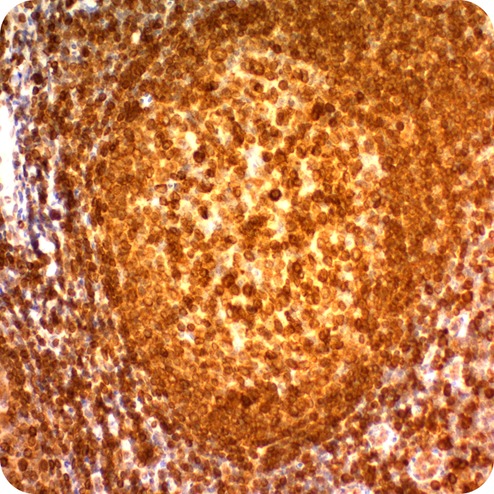 CD74 (B-Cell Marker); Clone LN-2 (Concentrate)