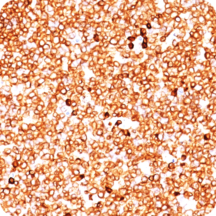 CD79a (B-Cell Marker); Clone JCB117 (Concentrate)