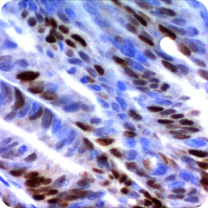 p21WAF1 (Tumor Suppressor Protein); Clone WA-1 (Concentrate)