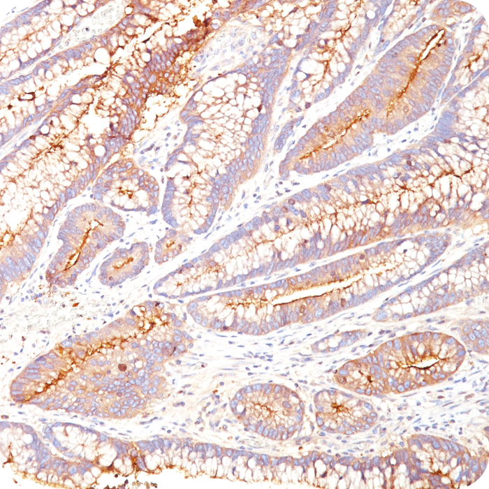 Carcinoembryonic Antigen (CEA) / CD66; Clone COL-1 (Concentrate)