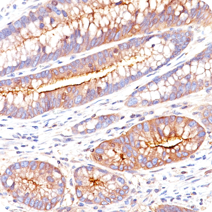 Carcinoembryonic Antigen (CEA) / CD66; Clone C66/261 (Concentrate)