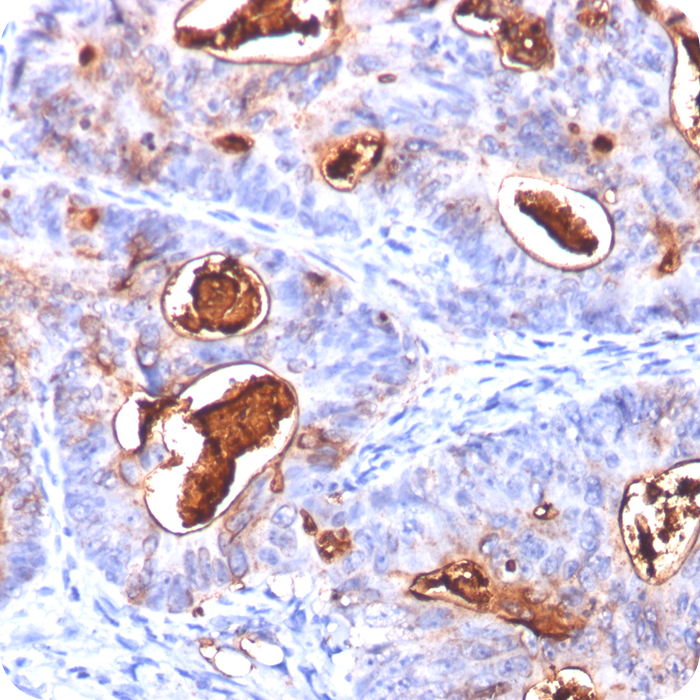 Carcinoembryonic Antigen (CEA) / CD66; Clone COL-1, CEA31 & C66/261 (Concentrate)
