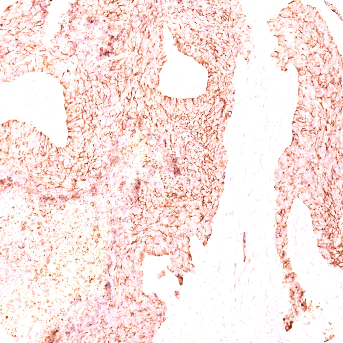 Chromogranin A / CHGA (Neuroendocrine Marker); Clone LK2H10 (Concentrate)