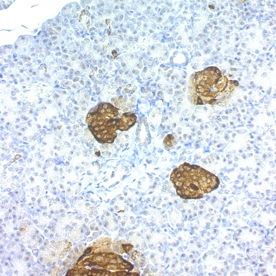 Chromogranin A / CHGA (Neuroendocrine Marker); Clone LK2H10 & PHE5 (Concentrate)