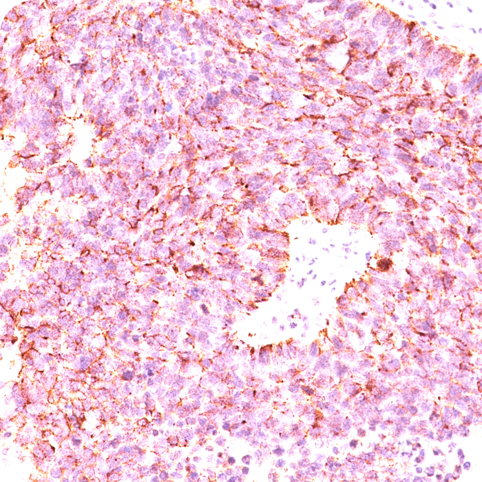 Chromogranin A / CHGA (Neuroendocrine Marker); Clone LK2H10, PHE5 & CGA/414 (Concentrate)