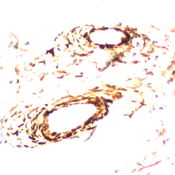 Calponin-1 (Smooth Muscle Marker); Clone CALP (Concentrate)