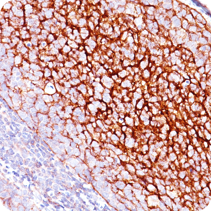 CD35 / CR1 (Follicular Dendritic Cell Marker); Clone E11 (Concentrate)