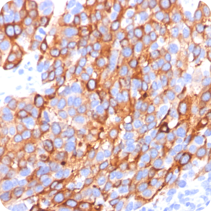 MART-1 / Melan-A / MLANA (Melanoma Marker); Clone A103, M2-7C10 & M2-9E3 (Concentrate)