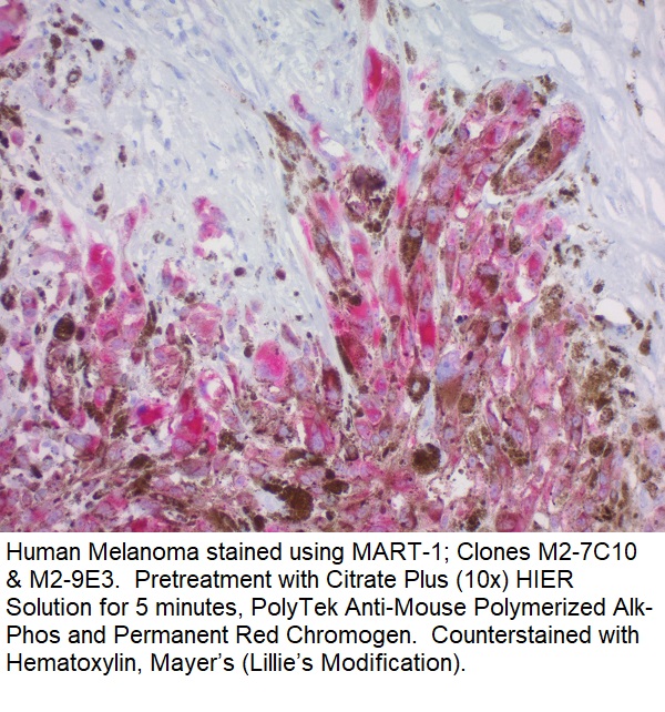 MART-1 / Melan-A / MLANA (Melanoma Marker); Clone M2-7C10 & M2-9E3 (Concentrate)