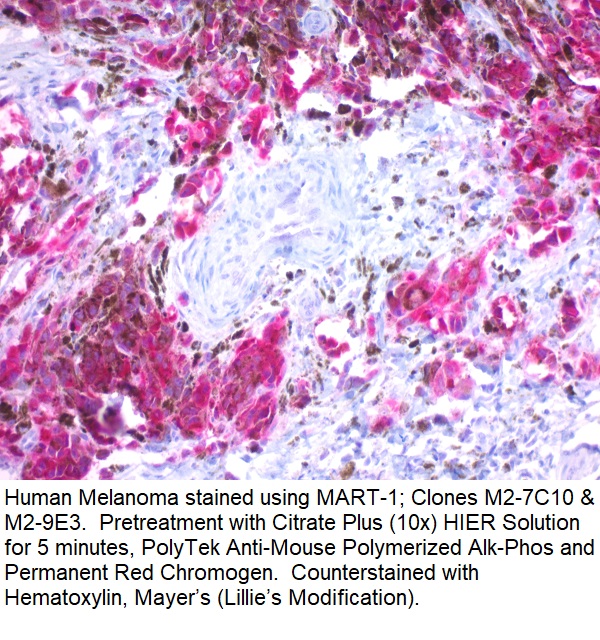 MART-1 / Melan-A / MLANA (Melanoma Marker); Clone M2-7C10 & M2-9E3 (Concentrate)