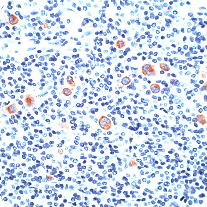 CD15 / FUT4 (Reed-Sternberg Cell Marker); Clone Leu-M1 (MMA) (Concentrate)