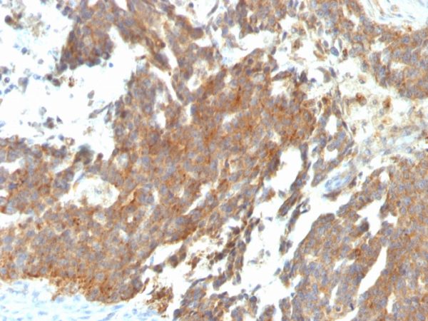 GnRH-Receptor / LH-RH Receptor; Clone GNRHR/768 (Concentrate)