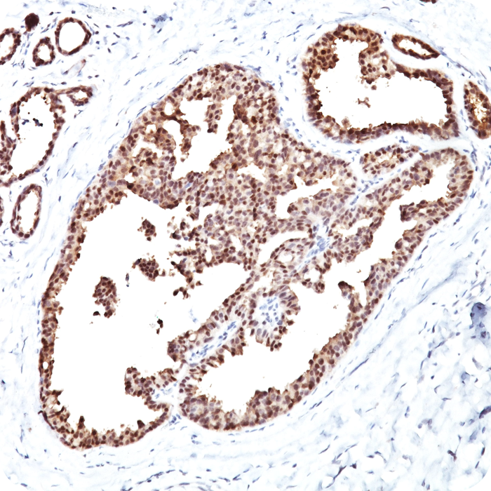 HSP60 (Heat Shock Protein 60); Clone LK1 (Concentrate)