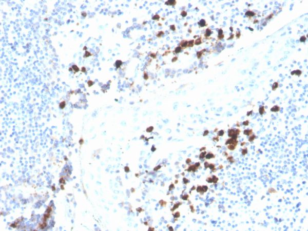 IgA (Immunoglobulin Alpha Heavy Chain) (B-Cell Marker); Clone rHISA43 (Concentrate)