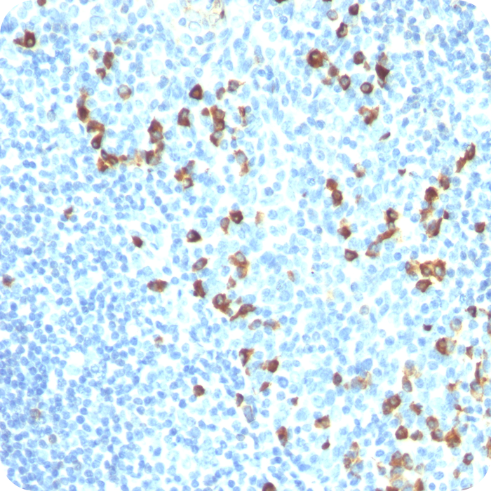 IgM (Immunoglobulin Mu Heavy Chain) (B-Cell Marker); Clone IM260 (Concentrate)