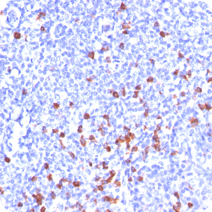 Kappa Light Chain (B-Cell marker); Clone L1C1 (Concentrate)