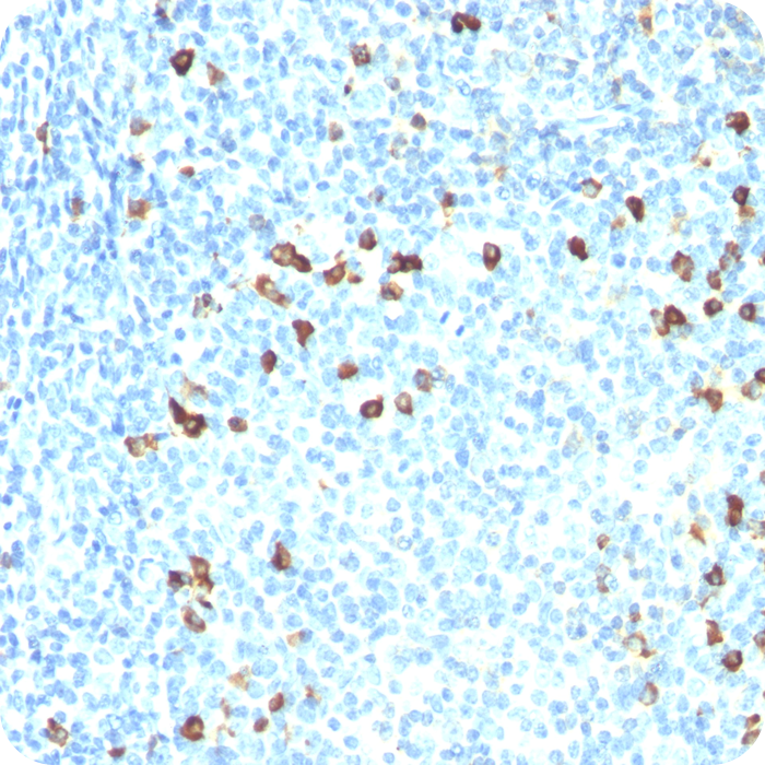 Lambda Light Chain (B-Cell Marker); Clone ICO-106 (Concentrate)