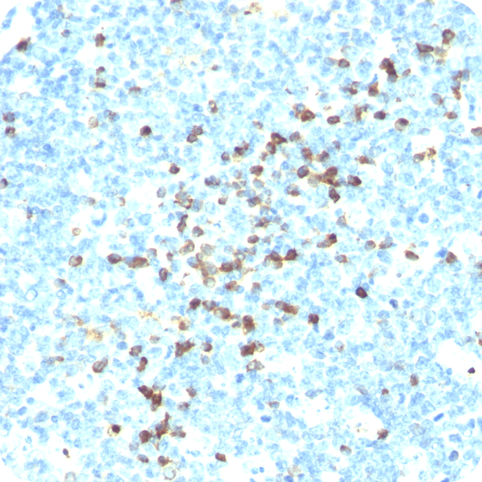 Lambda Light Chain (B-Cell Marker); Clone LAM03 (Concentrate)