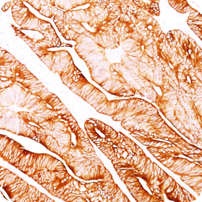 Cytokeratin 8 (KRT8); Clone H1 (Concentrate)