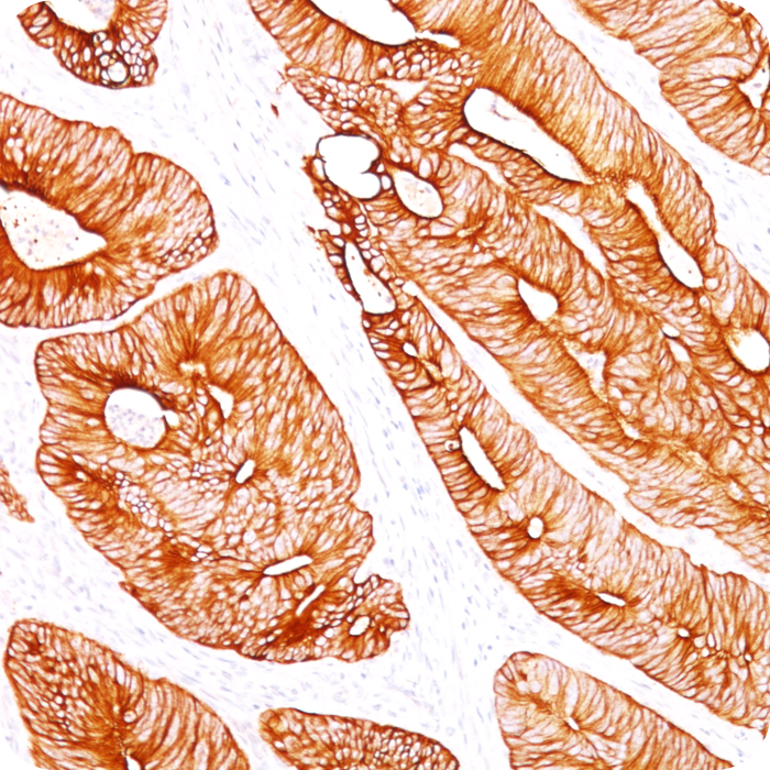 Cytokeratin 8 (KRT8); Clone K8/383 (Concentrate)