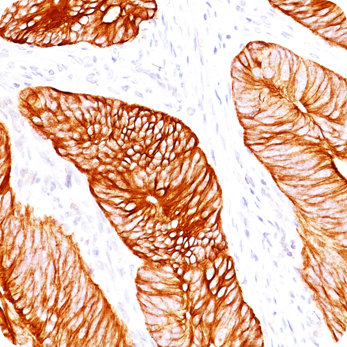 Cytokeratin 8 (KRT8); Clone H1 & TS1 (Concentrate)