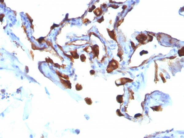 Cytokeratin 8 (KRT8); Clone KRT8/803 (Concentrate)