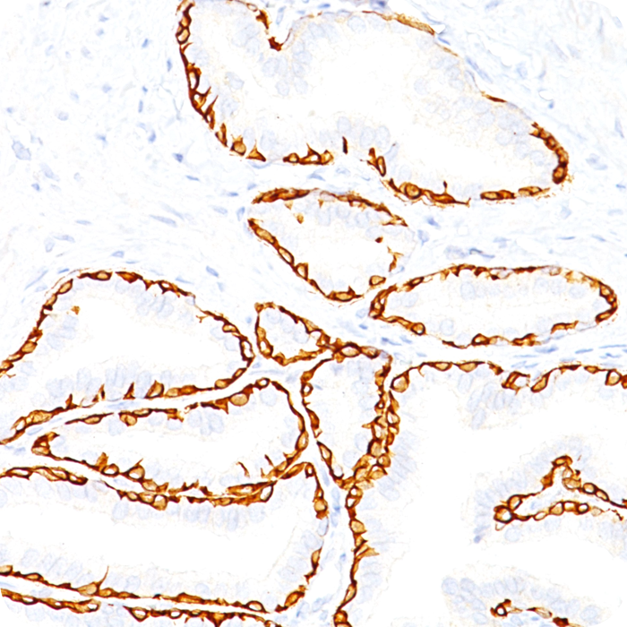 Cytokeratin 14 (KRT14) (Squamous Cell Marker); Clone LL002 (Concentrate)