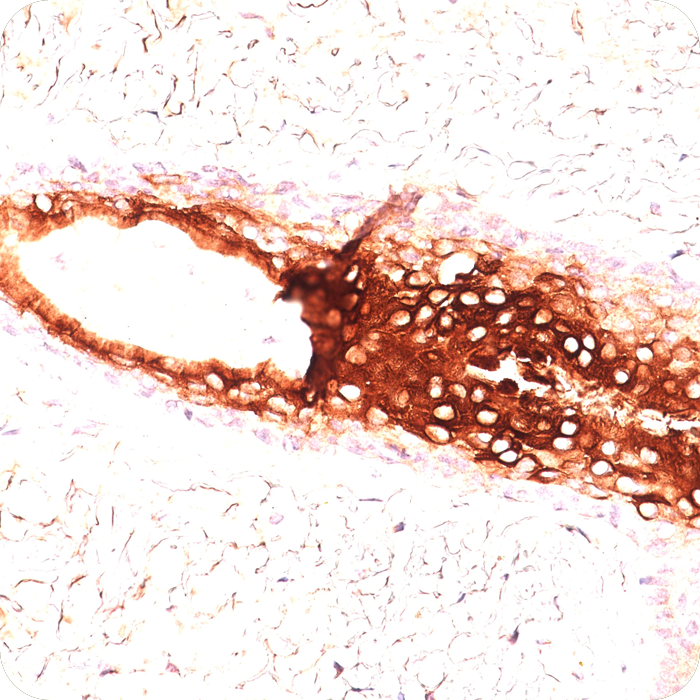 Cytokeratin 17 (KRT17) (Basal Epithelial Marker); Clone E3 (Ks17.E3) (Concentrate)