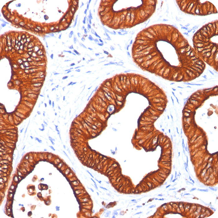 Cytokeratin 18 (KRT18); Clone DC10 (Concentrate)