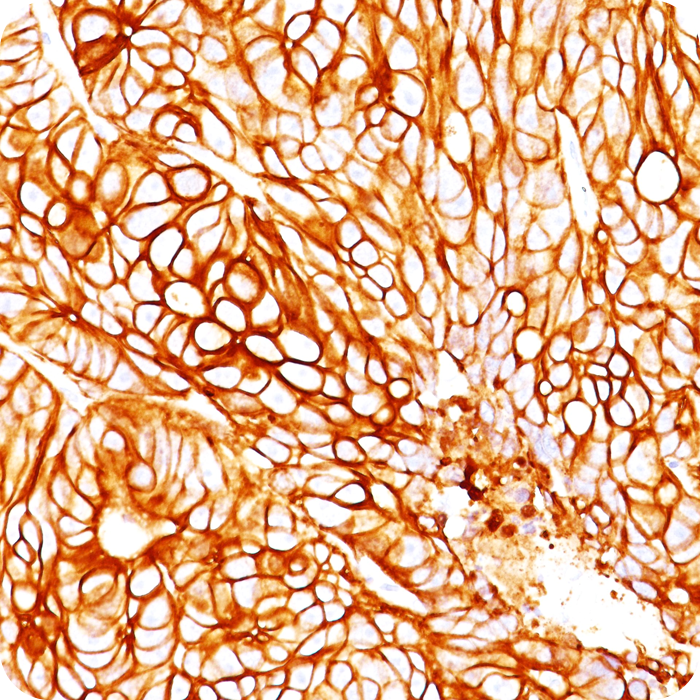 Cytokeratin 18 (KRT18); Clone DA7 (Concentrate)