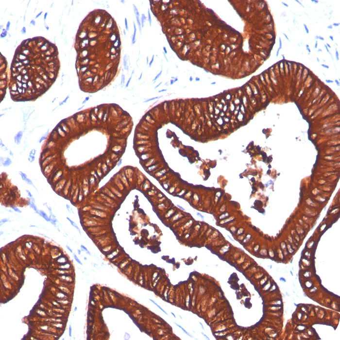 Cytokeratin 19 (KRT19) (Pancreatic Stem Cell Marker); Clone BA17 (Concentrate)