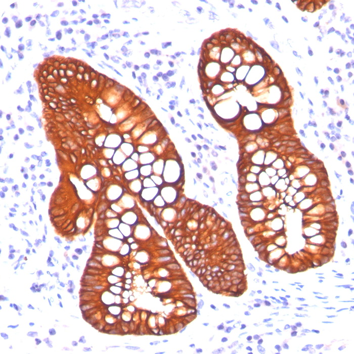 Cytokeratin 19 (KRT19) (Pancreatic Stem Cell Marker); Clone A53-B/A2.26 & BA17 (Concentrate)