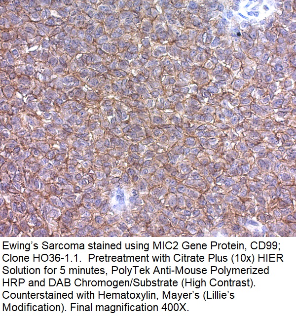 CD99 / MIC2 (Ewing's Sarcoma Marker); Clone HO36-1.1 (Concentrate)