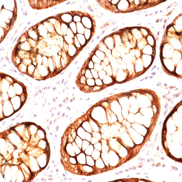 MUC1 / EMA / CD227 (Epithelial Marker); Clone GP1.4 & E29 (Concentrate)