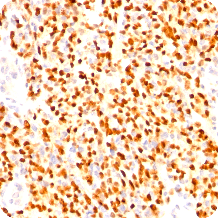 MyoD1 (Rhabdomyosarcoma Marker); Clone 5.8A & MYD712 (Concentrate)